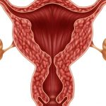 Una mujer con ovarios poliquísticos tiene mayores posibilidades de pérdidas, desarrollo de diabetes gestacional y alzas de presión sanguínea.