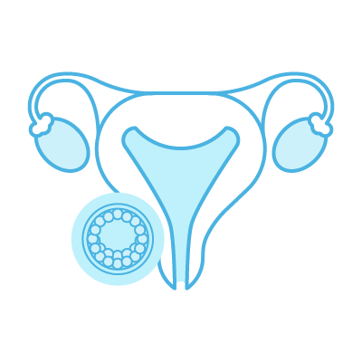 Preparación endometrial y transferencia del mejor embrión